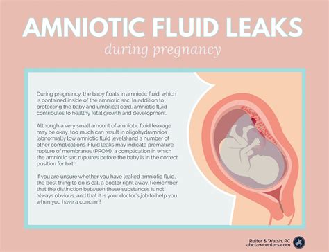 leaking amniotic fluid symptoms|Leaking amniotic fluid: Signs and what to do